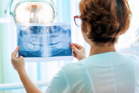 orthodontist checking an x-ray