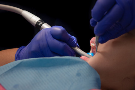 Emergency dental surgery